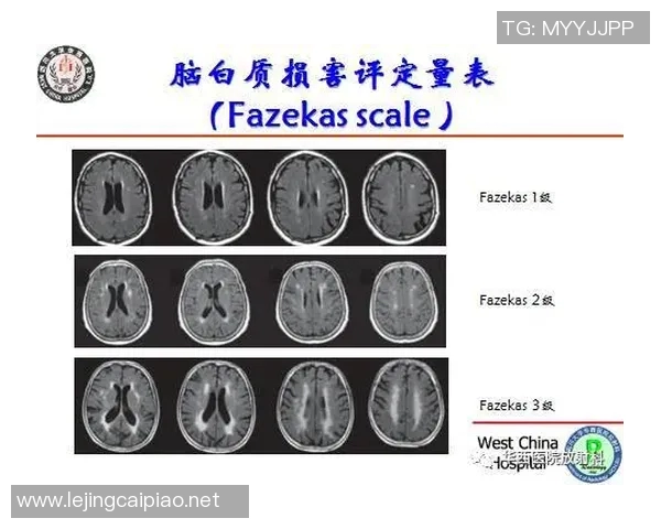 全球挑战赛中LNG意识表现的深度分析与评估 全球挑战赛中LNG意识表现的深度分析与评估